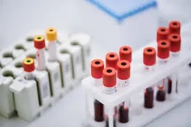 Ghid practic de analize medicale recomandate