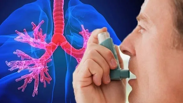 Peste un milion de români suferă de astm bronșic